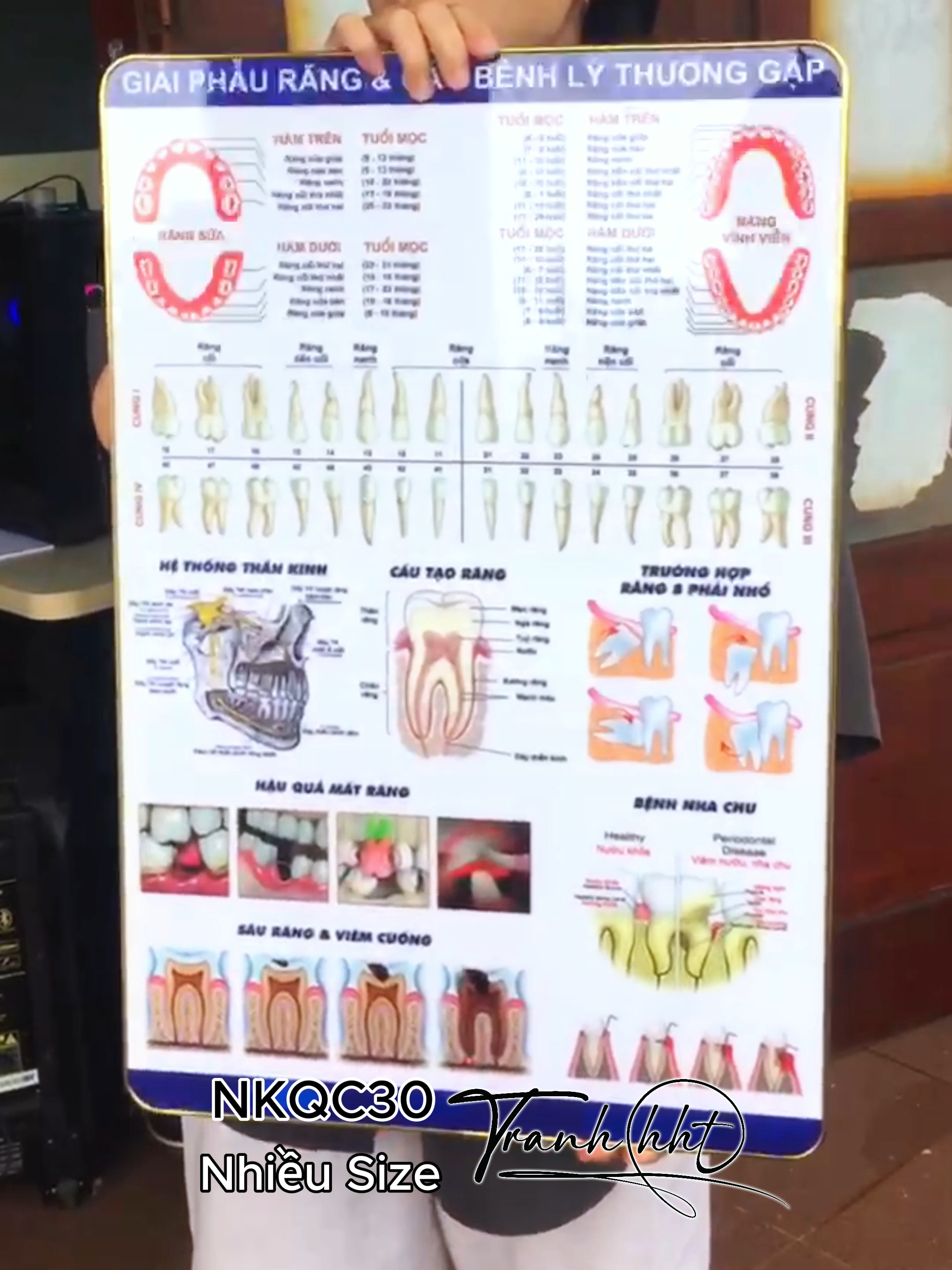 Tranh phòng khám nha khoa, tranh nha khoa treo tường, tranh răng implant, tranh Nha NKQC30 #nhakhoa #tranhnhakhoa #tranhphongkhamnha #tranhimplant #implant