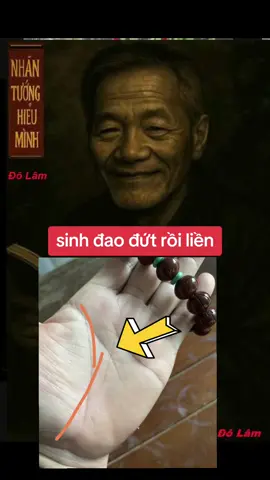sinh đạo đứt #xemchitay #nhantuong #xemtay #nhantuonghieuminh #nhantuong 