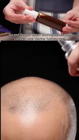 Forget about gray hair_ Fast hair growth and return to its natural color_ ONLY natural ingredients#hair #hairgrowth #hairgrowthtips #hairspray 