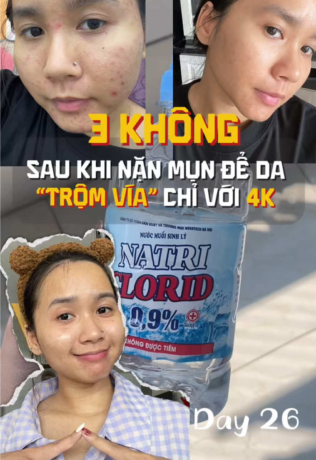 Sau nặn mình chăm da như thế nào? #skincare #damun #munan #nanmun #nuocmuoisinhly 