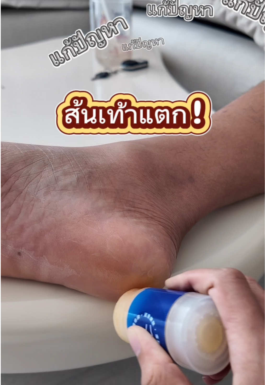 ส้นเท้าแตก รีบแก้ด่วน! #ส้นเท้าแตก #ส้นเท้าแตกด้าน😨😨 #ส้นเท้าแห้งด้าน 