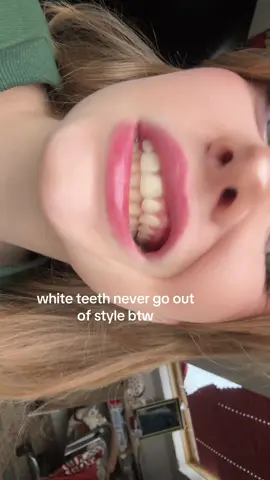 the best accessory #teethwhitening 