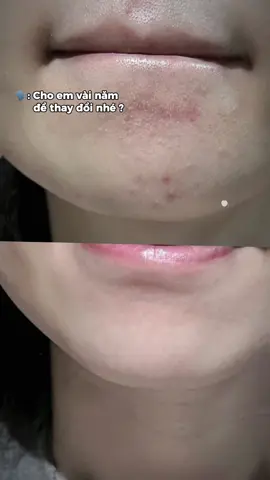 Cách nhanh nhất để có tình yêu là tự yêu bản thân trước#trangda #lamdep #tip 