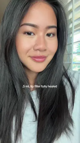 No regerts #lipfiller #lipinjection 