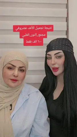 #تجميل_الأنف #دكتورة_نور_امين #مجمع_النور_الطبي 