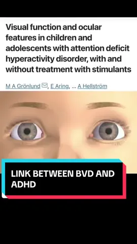 Comments I get from people who know nothing about BVD or ADHD… Here’s just a few studies and research articles showing how vision plays a major role in focus, attention, and brain function. Most people have no idea how much their eyes can affect their daily life. Learn more or book a consultation at www.vividvisionsoptometry.com/appointments. Located in Valencia, California, with virtual visits available. #BVD #PrismGlasses #VisionTherapy #BehavioralOptometry  #onthisday 