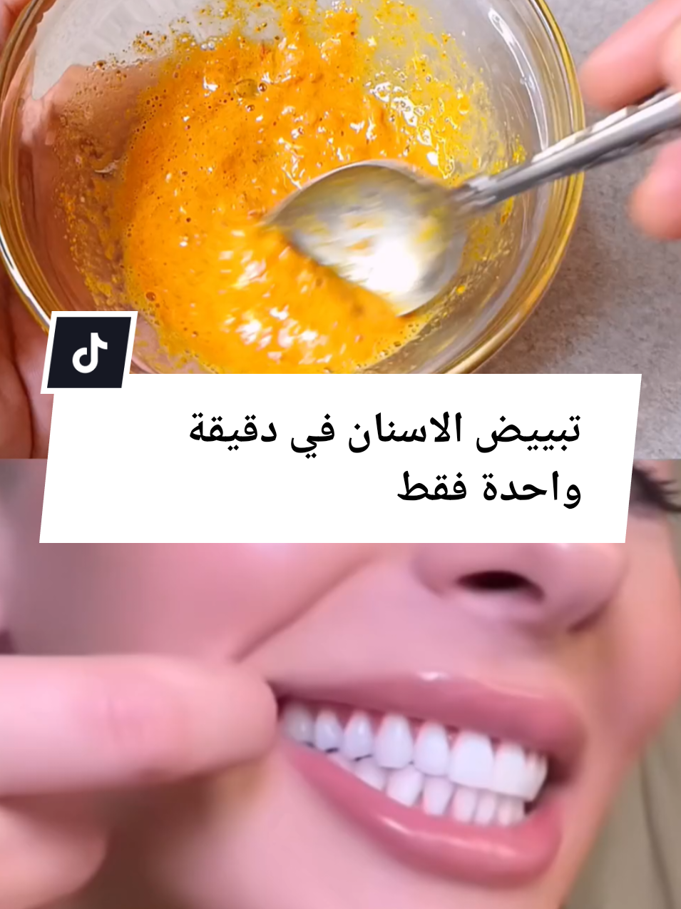 #تبييض الاسنان في دقيقة واحدة فقط #كل اللي حوالك هيسالك عن بياص اسنانك#fyppanpage #france #الشعب_الصيني_ماله_حل😂😂الحلال 