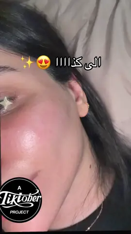 الالتزام بالجلسات يصنع بشرة الأحلاااااام  😍✨✨✨✨ @Dr:Nesma Soultan👩🏻‍⚕️💉 