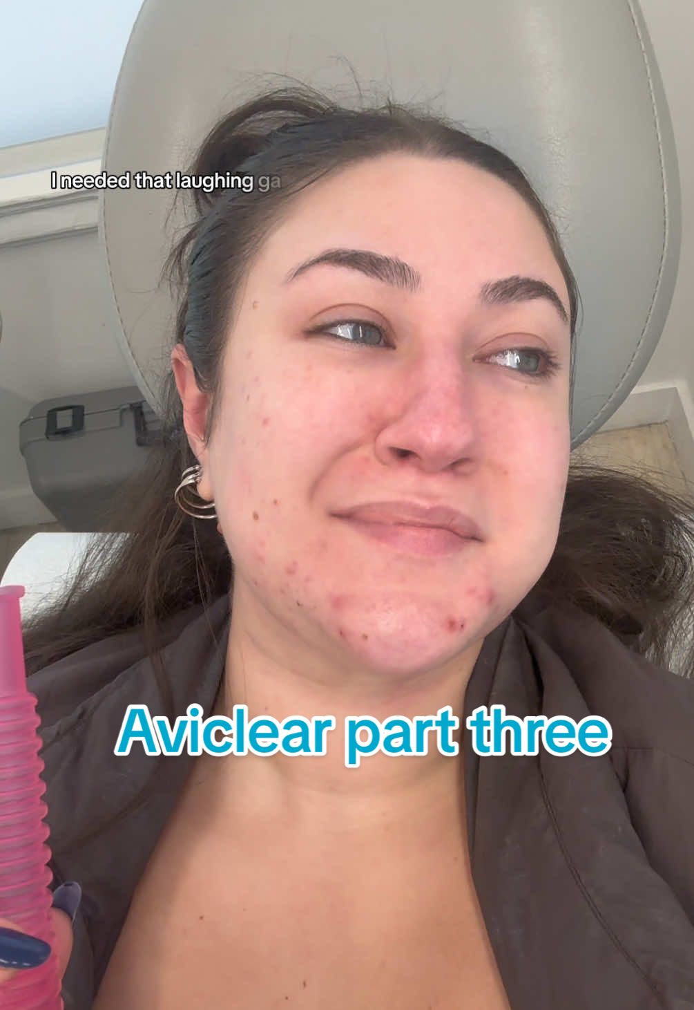 Fellow aviclear girlies when did you start seeing results sos 