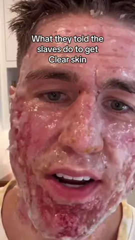 Clav  Mr  🧃isn’t gonna like this. But I’ve been saying diet is everything I gave the free sauce 