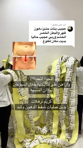 #خلطات_طبيعية #عمليات_تجميل #سر_العتيبيات #حوايج_نفاس #عناية_بالبشرة 