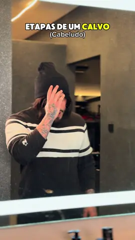 As etapas de um calvo #fyp #humor #viral 