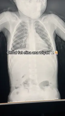 #fyp #viral #foryoupage #algeria #medecine 