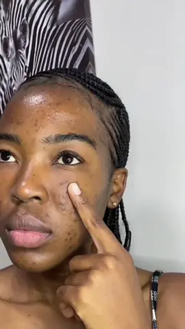 #theacneset #theordinary #facepackforacne #mamanmakeupchezpapi #mamanmakeup 