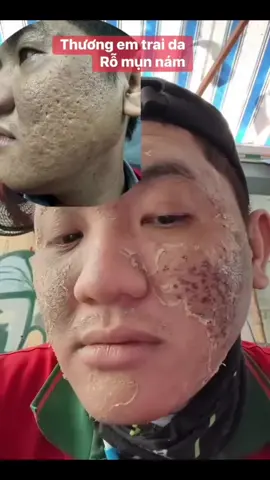 Ca Rỗ đang đc làm đầy lên cho e zai nhé #munnamtannhang #videoreelsシ #xuhuongreels 