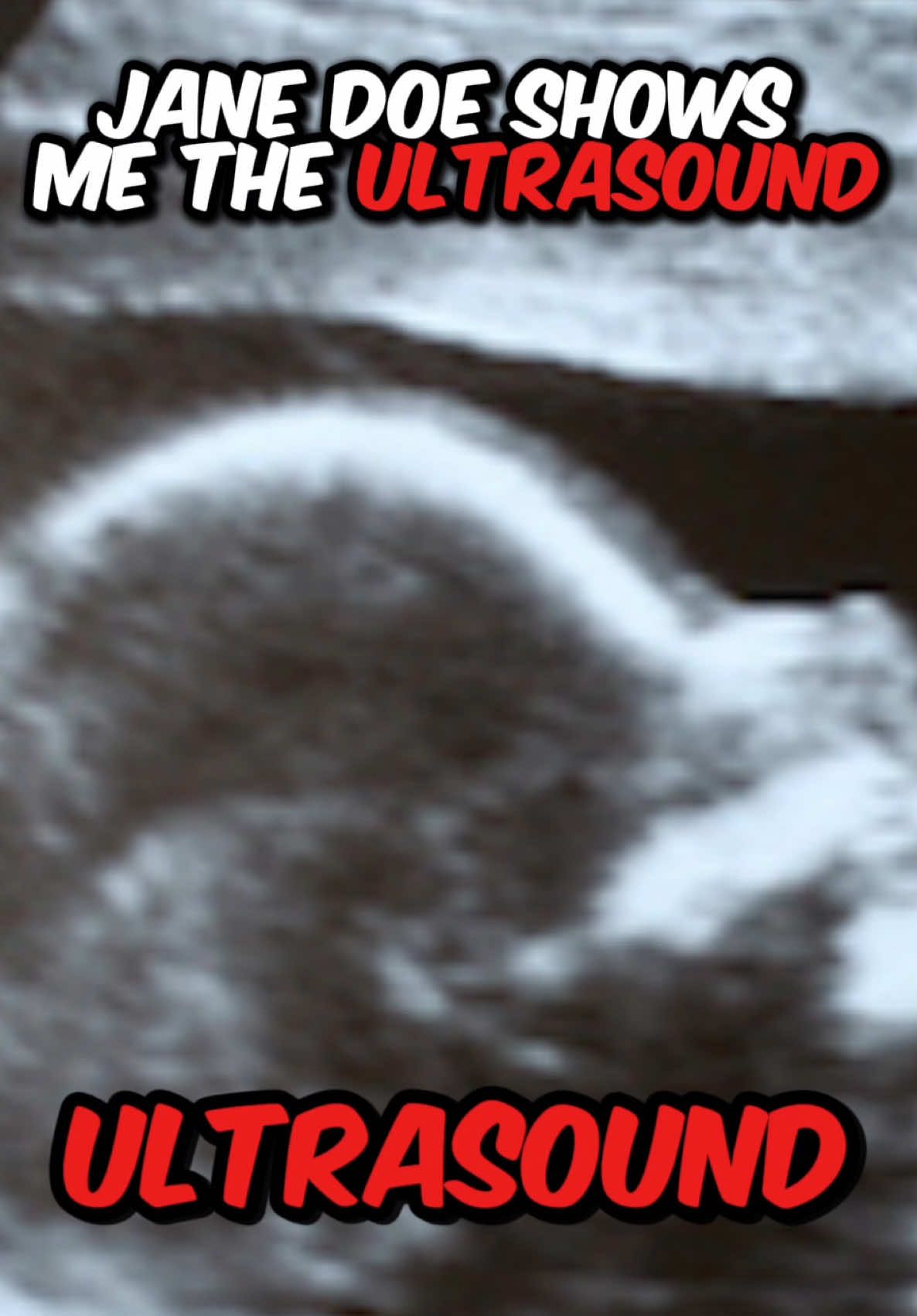 The Day Jane Showed Me The Baby’s Ultrasound 🫩 #creatorsearchinsights #zenlesszonezero #zzz #cai  #janedoe 