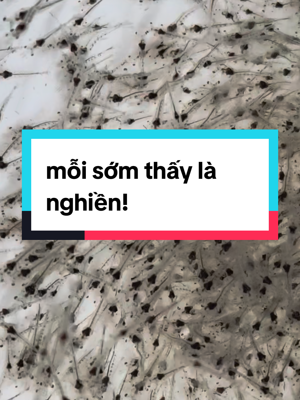 Ba triệu hai tôm giống... đi để đến đích! #xuhuong #topthinhhanh #nuoitomcongnghecao #nuoitomtrenaolotbat #soibiennuoitom 