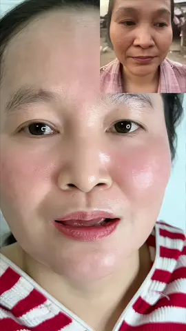 Tin chất hút sắc tố tầng sâu#peelda #nám_tàn_nhang_mụn_thâm #xuhuong #lamdeptainha 