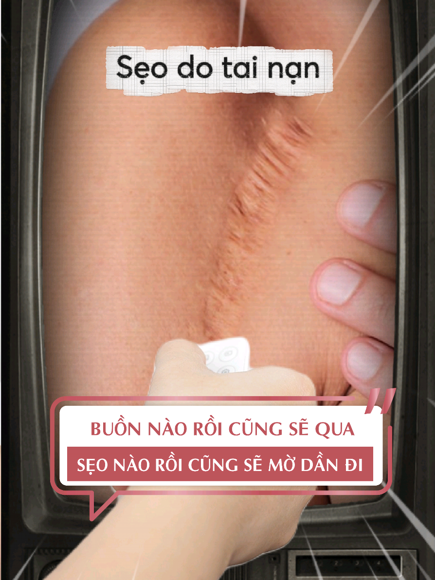 Đừng để vết sẹo thành nỗi ám ảnh - dùng Scar Gel sớm nha #fixderma #scargel #mothamseo #seoloi 