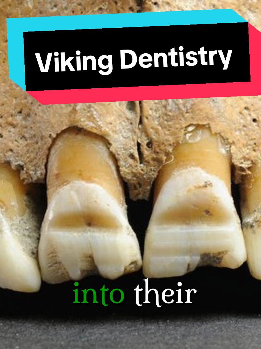 Forget horn helmets. The REAL reason Viking warriors were terrifying was their TEETH. Archaeologists found skulls with deep, filed grooves. They'd dye them blue or red for battle. Imagine that smile charging at you. 😱 . . .  #Vikings #HistoryTok #Archaeology #tiktokhalloweencontest 
