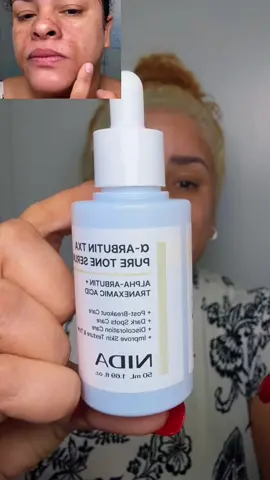 Nida serum para eliminar manchas oscuras  #nida #serum #hiperpigmentacion #hyperpigmentationskincare #tiktokshopfalldealsforyou 