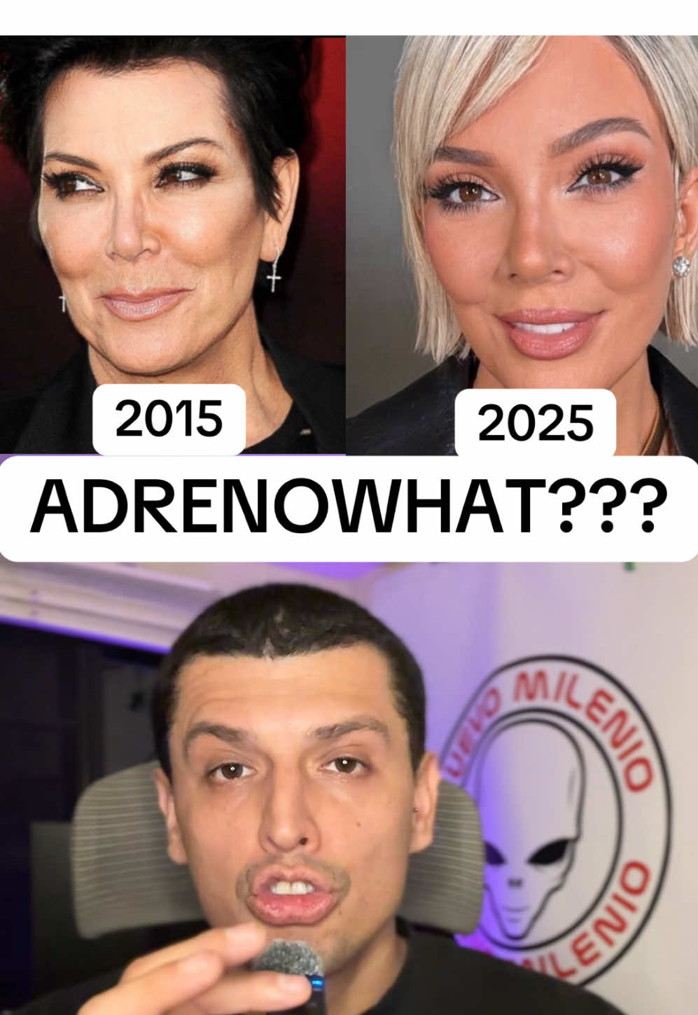 A QUE SE DEBE EL REJUVENECIMIENTO DE ALGUNAS ESTRELLAS DE HOLLYWOOD? #nuevomilenio 