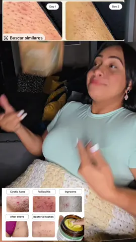 #tiktok #paratiiiiiiiiiiiiiiiiiiiiiiiiiiiiiii #tiktokshop #piel 