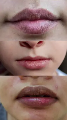 Reasons why your lips are DARK and DRY 🥺🫣 sharing with you one of my newest product discovered that really helps me with my dark lips  #belanidarklip #belani 