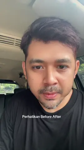 Krim Glowing viral 2 lebih murah #heyxi #heyxiindonesia #retinol #glowing 