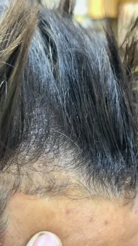 #نصائح #علج #الشعب_الصيني_ماله_حل😂😂 #مالي_خلق_احط_هاشتاقات #قسنطينة 