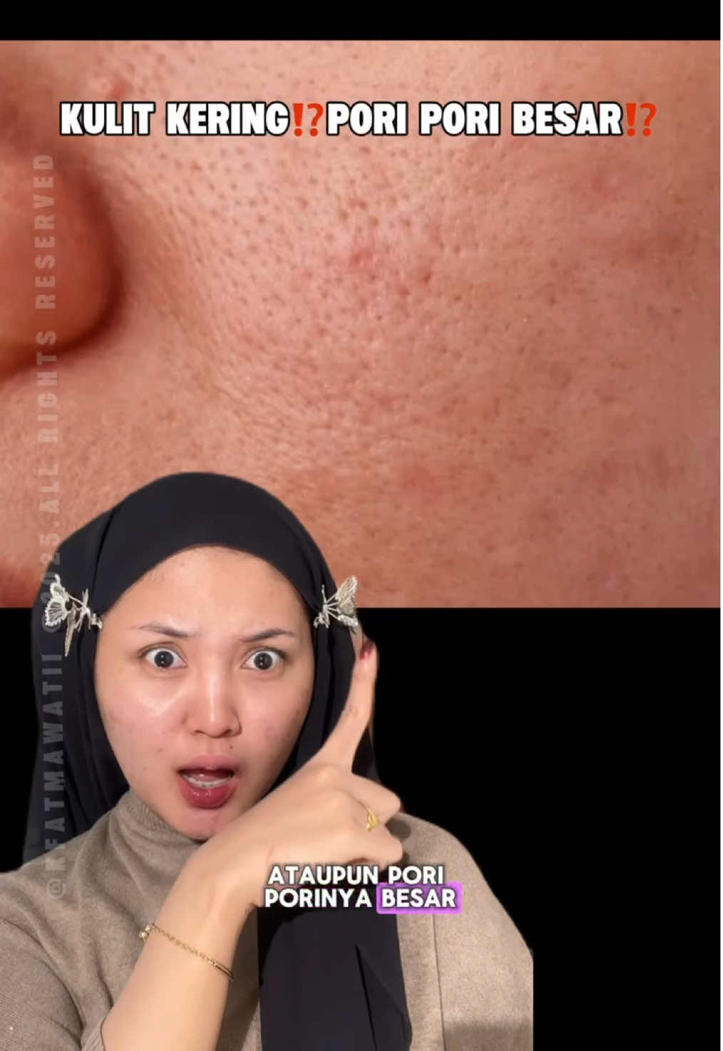 Kulit kering sensitive ga bisa sembarang pilih toner☝️🙂  Selain bisa untuk skincare bisa juga untuk base makeup😆🤏 #hydratingtoner #tonerdojako #dojakoskincare 