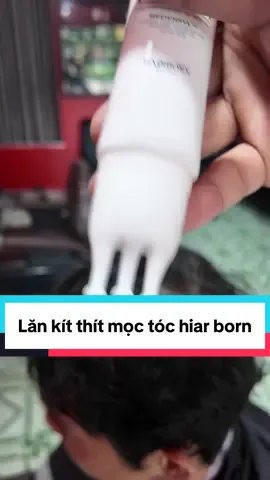 Lăn kít thít mọc Tóc Hair born#Hôntô #hairborn 