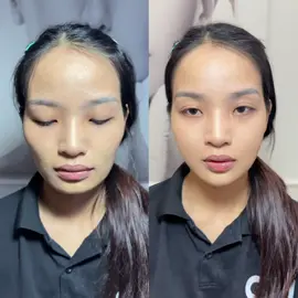 Cam thường 100% , các đồng nghiệp nhớ chụp trước và sau cho khách xem k khách lại bảo k thấy khác gi 😒