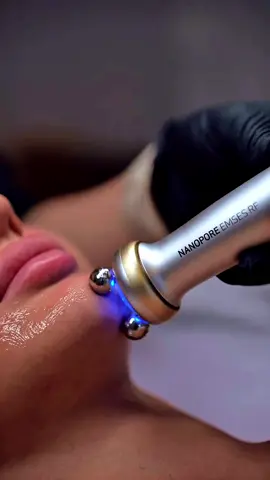 💆‍♀️ Da chảy xệ, kém săn chắc mà ngại xâm lấn? 👉 Thử ngay RFEMS – công nghệ trẻ hoá chuẩn y khoa từ Medi+derma (Tây Ban Nha) 🇪🇸 💡 Sóng RF kích thích tăng sinh collagen & elastin ⚡ Vi dòng EMS nâng cơ, săn chắc cơ mặt tự nhiên ➡️ Kết quả: Da căng mịn – Mặt thon gọn – Sáng hồng rạng rỡ ✨ Không đau ❌ Không nghỉ dưỡng ❌ Chỉ sau vài buổi, bạn sẽ thấy làn da như được “bật filter thật” 🪞💖 #MediDerma #RFEMS #TreHoaDa #NangCoKhongXamLan #CapCut 