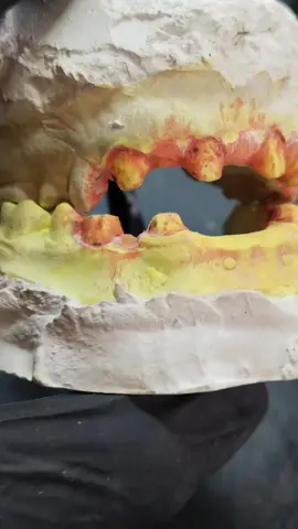 PFM#ilyasidentalservice #PESHAWAR 