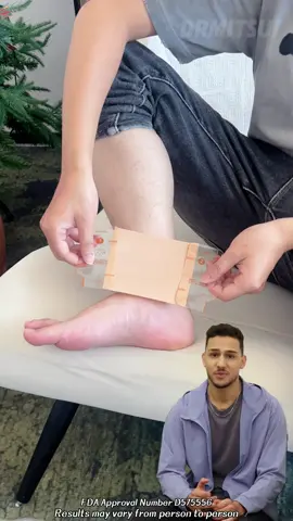 The intense pain of a gout attack can be unbearable. Try our Gout Patch! It deeply penetrates to soothe joint inflammation and relieve the discomfort caused by gout. Simply apply it, and easily manage every gout flare-up, saying goodbye to pain and restoring comfort to your life! 💪🌟#GoutRelief #JointCare #HealthyLiving  #DRMITSUI#wy