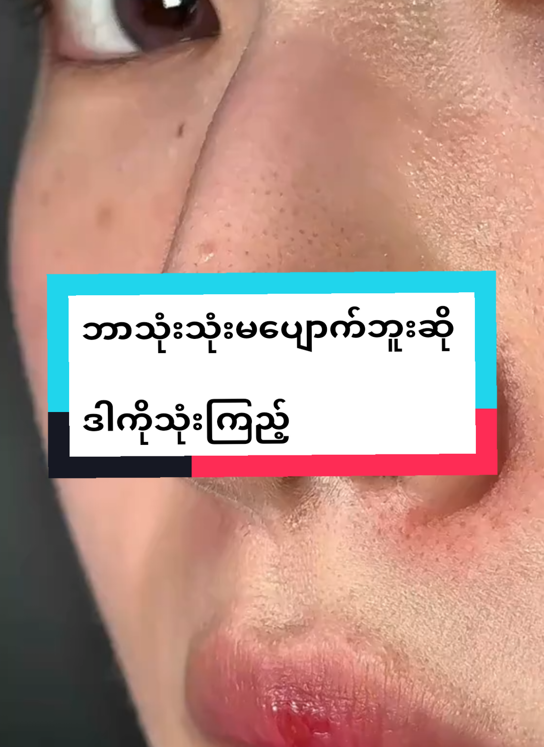 #ဝက်ခြံပျောက်ချင်သူများအတွက် #teပျားမျက်နှာသစ်ဆပ်ပြာ #09664971055 #eaintonlineshop#ရန်ကုန်ကိုယ်စားလှယ်ကြီး 