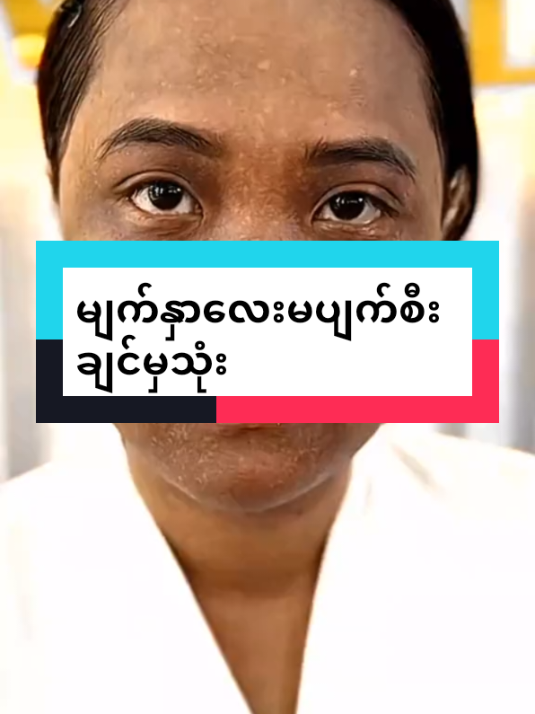 #poepoe #hcproductmyanmar #ပခုက္ကူကိုယ်စားလှယ်ကြီး #09797444122📱📱orviber #မျက်နှာလေးမပျက်းစီးချင်မှသုံး 