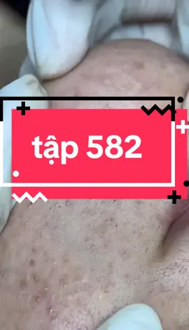 #nguyenchuyenmun #nanmunbangtay #chamdakhoahoc #govap #bentre71🌴🥥 