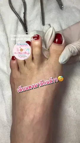 💓 #namthipnails #ตัดเล็บขบ #ตัดหนัง #ทำเล็บ #ร้านตัดเล็บขบ      Fb : namthipnails  Line : @namthipnails  