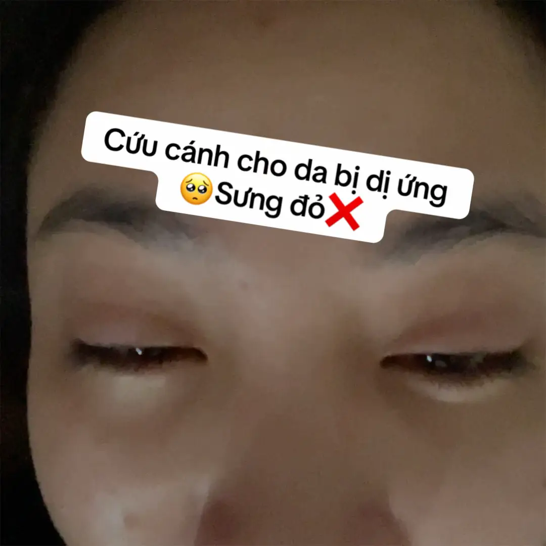 Em kem dưỡng Cicaplast B5 này đúng là bestie của làn da lun đó, chăm da từ lcl tới bề mặt lun nè #larocheposayvn #cicaplast  