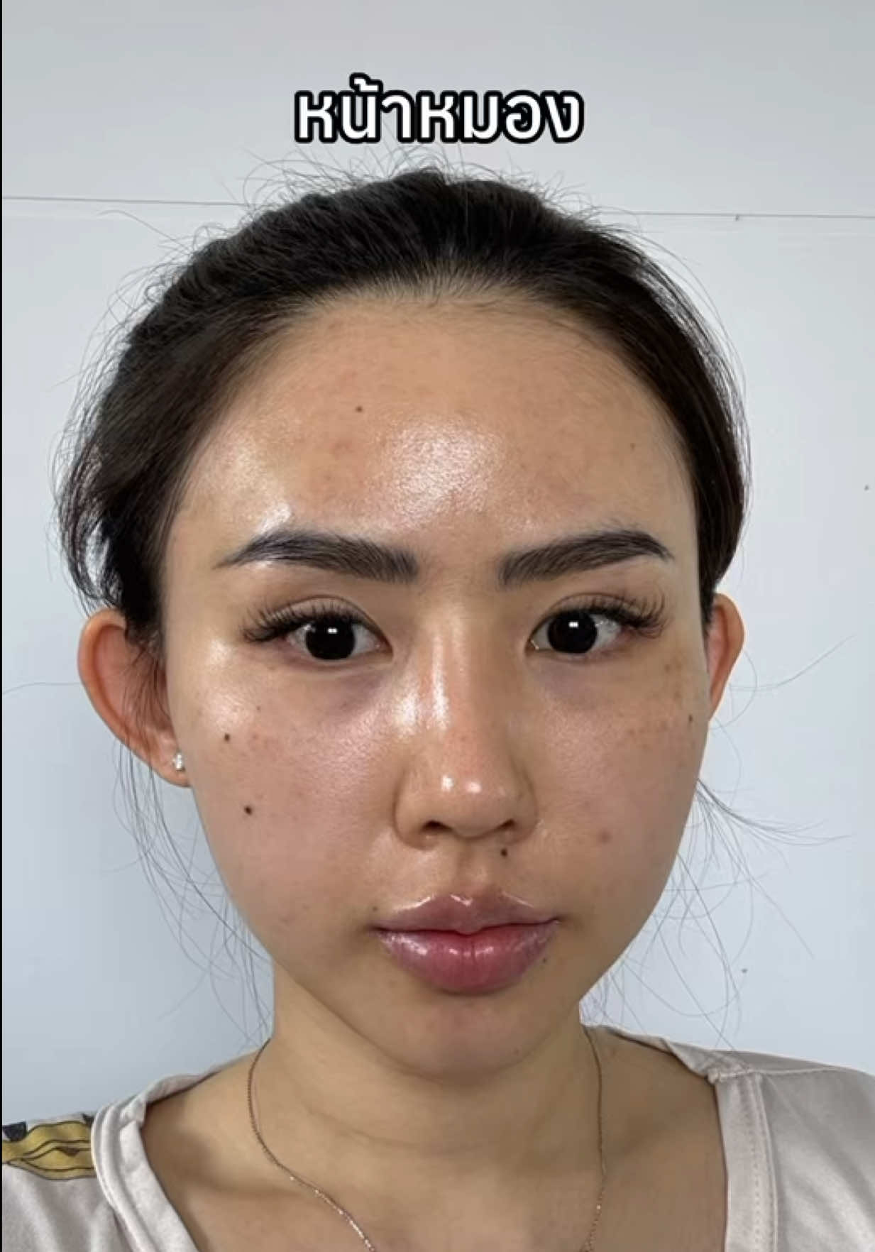 ปัญหาโลกแตกที่ใครต้องเจอ… #เปลี่ยนแปลงตัวเอง #หน้าใส #น้ำตบไบรท์ #น้ําตบลานอส #ดูแลตัวเอง 