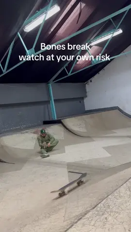 Worst day of my life 😂 Follow me for a update 👌#skateboard #fyp #viral #trimalleolar #anklebreaker 