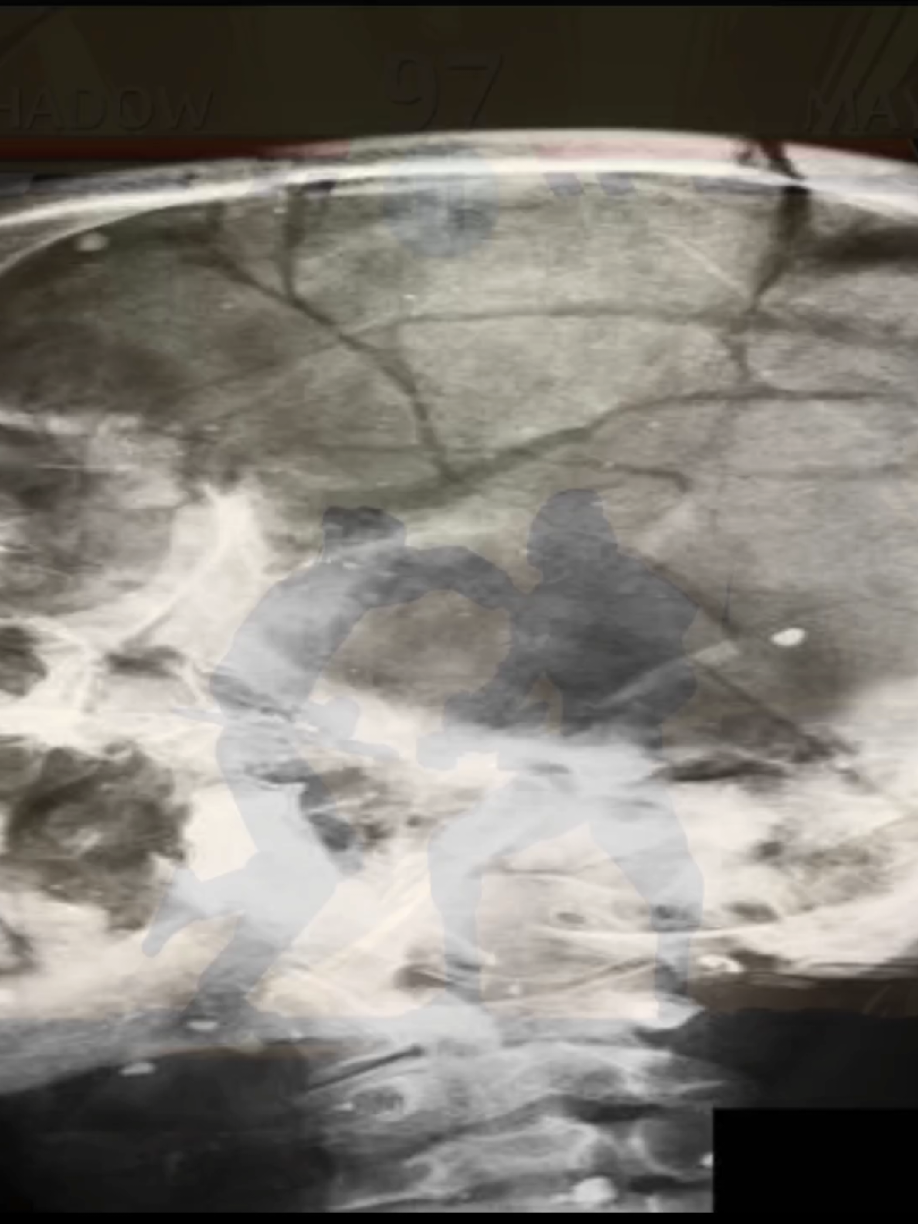 shadow fight 2  but my soundboard is possessed by demons rate my soundboard y'all  💔🥀✌️ @Batman Shadow Fight @John Shadow Fight @Dark shadow fight @Solio Games @LYNX @𓃵 🜲 𝐢𝐫𝐨𝐧𝐜𝐥𝐚𝐝 ⚊⟭■■◤ 