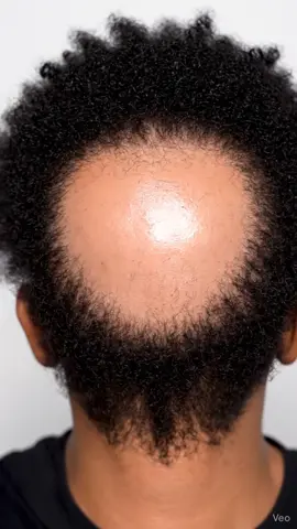 tag who need someone #asmr #satisfyingvideo #hair #curlyhair #hairtrend 