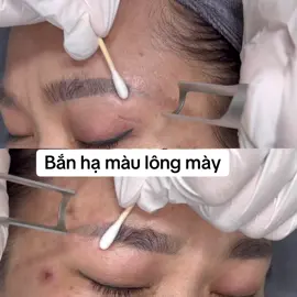 Hạ màu lông mày bằng lazer trục khuỷu #spa #lazercongnghecao #trietlong #duocmypham #duocmyphamchauau 