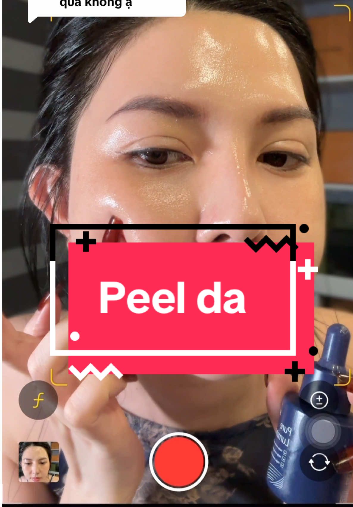 Trả lời @ngocnhubaby2 peel kết hợp dưỡng phục hồi da cải thiện nám, tàn nhang tốt và giúp làm đều màu da giúp da căng bóng và hấp thụ duỡng chất rất tốt mn nha #beskin #beskinvietnam #totuyettram #peeldatainha #peelbeskin 