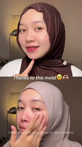 Akhirnya setelah 3 minggu lebih bisa ngerasain perubahannya🥹🫶🏻 #msglow #acneblemishmoisturizer #acnemoistmsglow #byPeti 