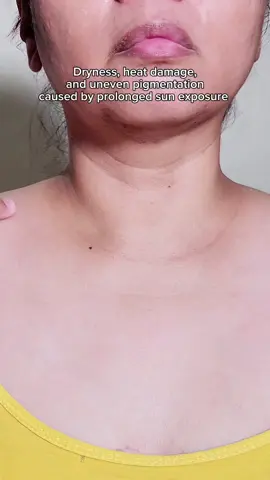 After Tan Duo @numbuzin_global  #numbuzin  #numbuzinmates  #no5tonerpad  #no5serum  #koreanskincare 