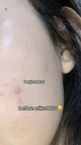 ga nyangka bisa se ngaruh itu🥹 #moisturizerviral #facerinna 